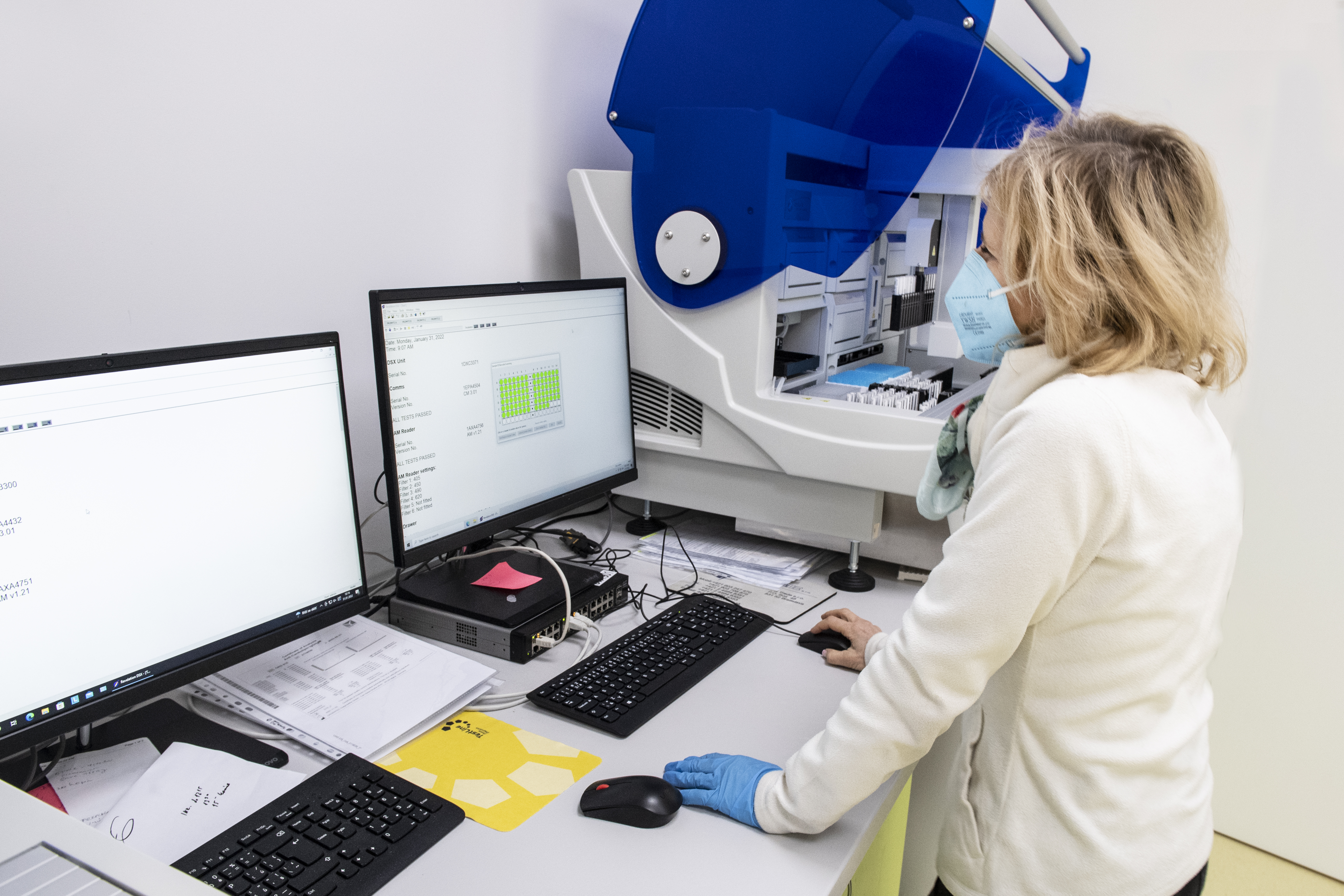 Slovenskí vedci odhalili enzým spojený s rizikom úmrtí na covid-19