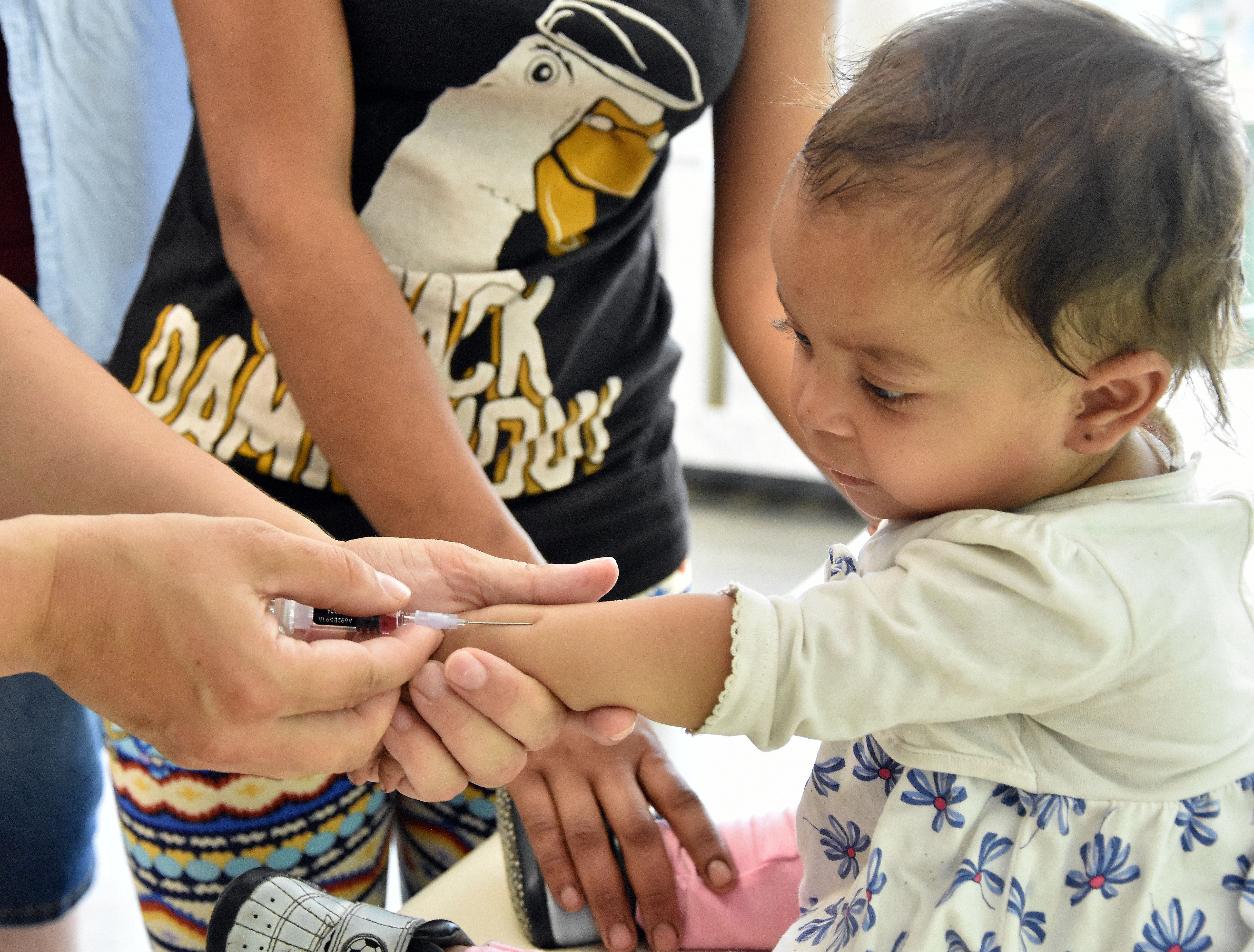 Hlavný hygienik: Nie sú vedecké dôkazy o tom, že vakcína proti osýpkam spôsobuje autizmus