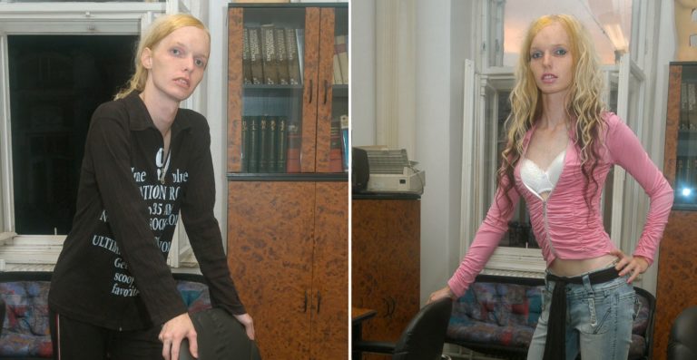 Pri zmene pohlavia by sa po novom nemalo meniť rodné číslo