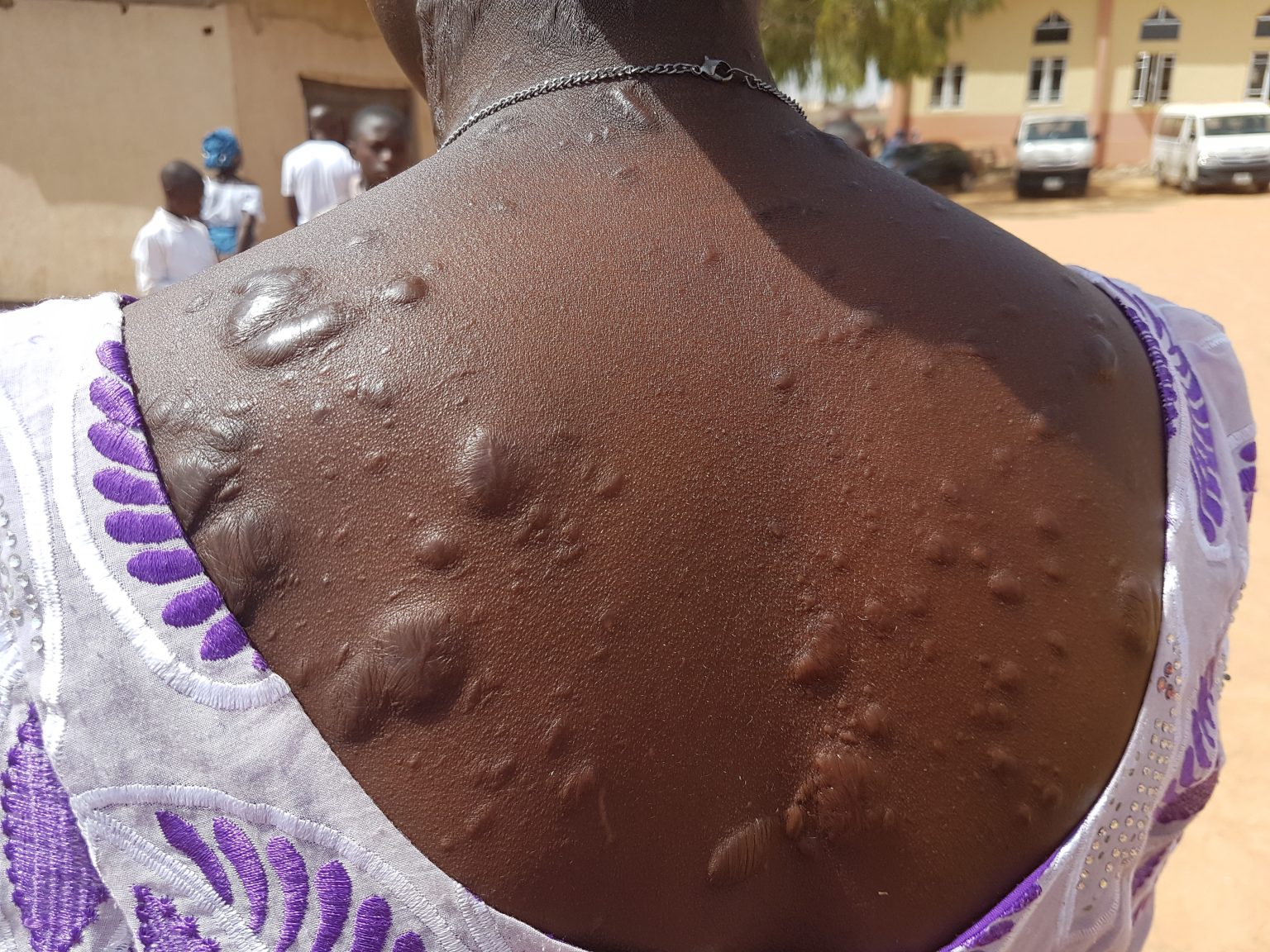 Žena, ktorá prežila bombový útok na Kostol svätej Rity, Nigéria, Kaduna. Foto: ACN