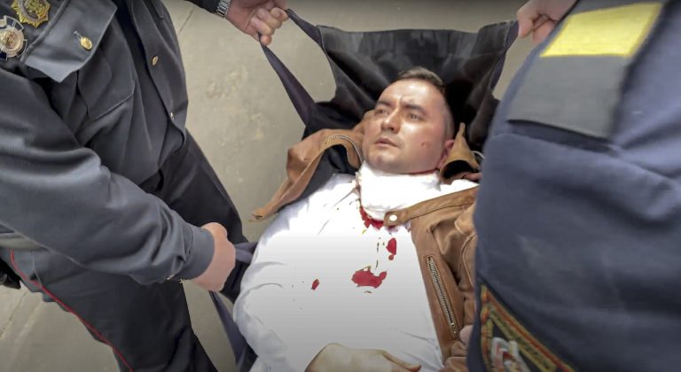  Zadržiavaný bieloruský aktivista Sciapan Latypav sa počas prvého dňa súdneho pojednávania pokúsil o samovraždu 1. júna 2021 v Minsku. Foto: TASR/AP