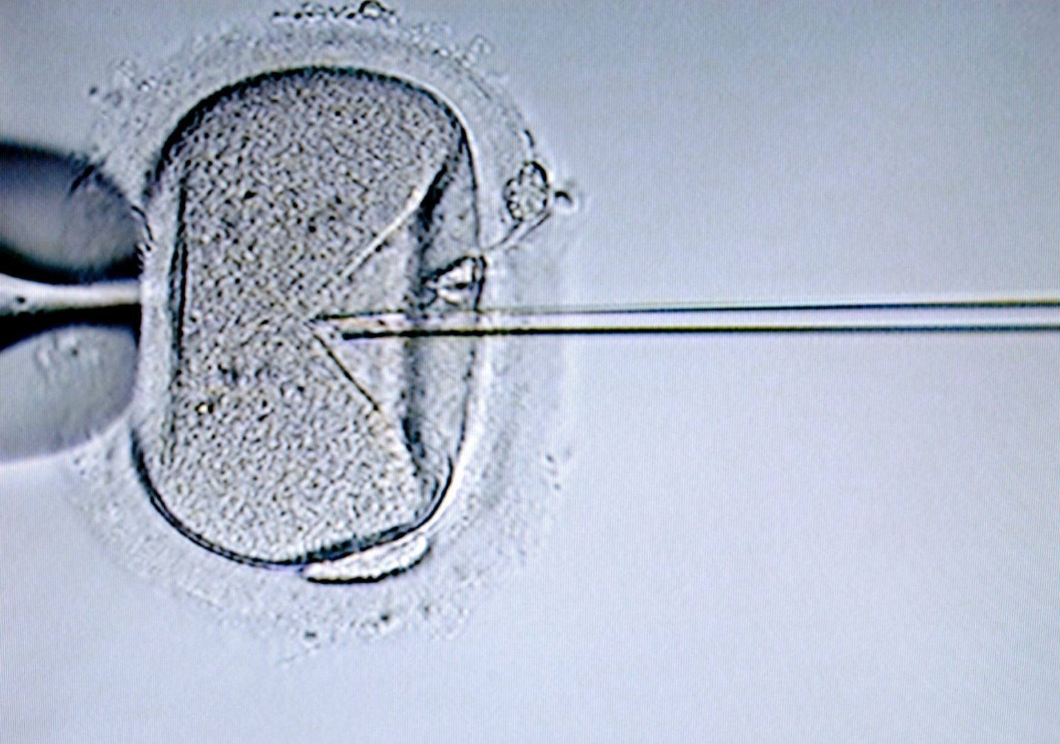 Ilustračné foto: umelé oplodnenie (IVF). Profimedia.sk