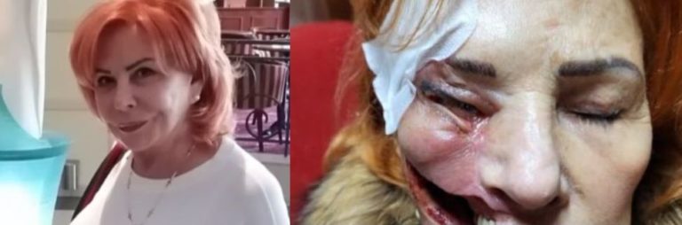 Lekári jej diagnostikovali neznámeho parazita, ktorý jej postupne požiera tvár. Zdroj: TV Markíza