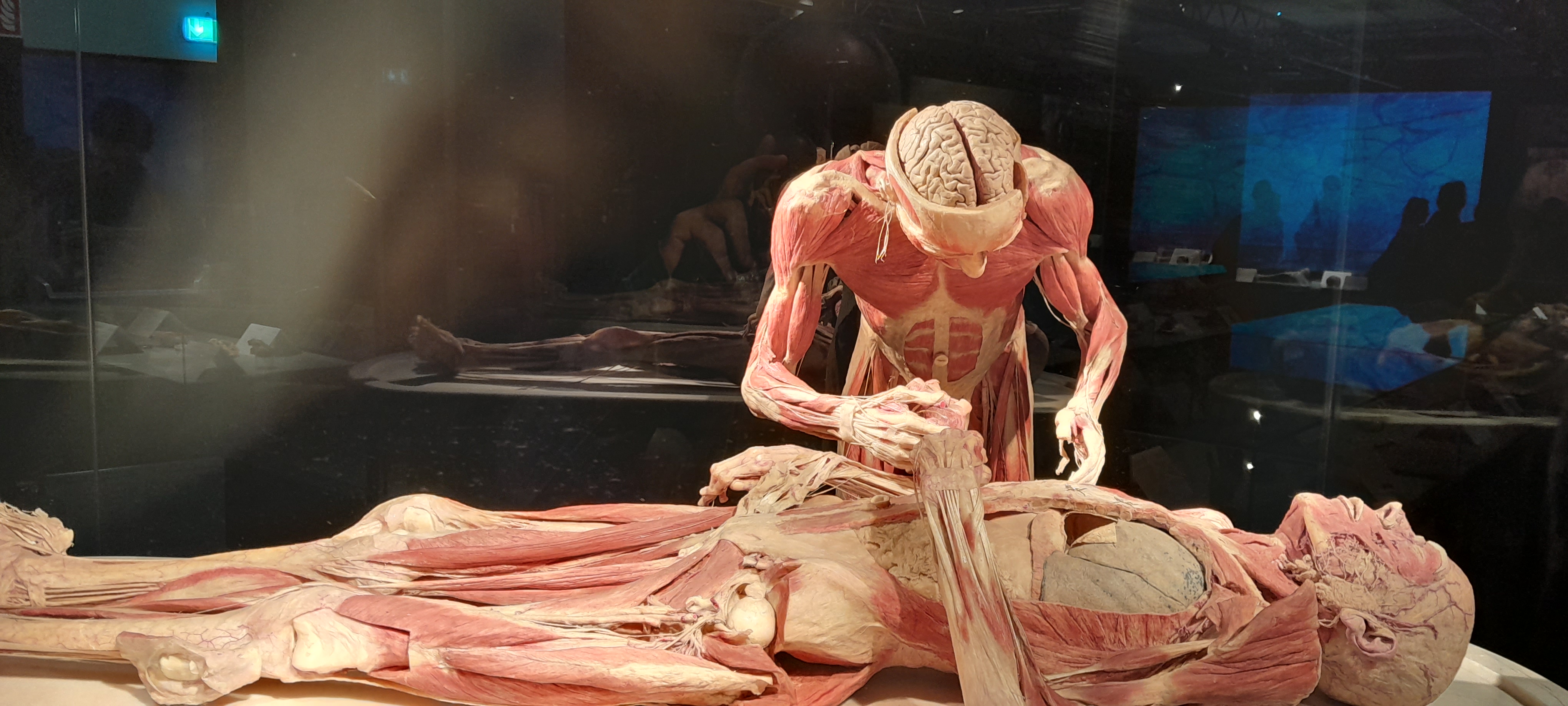 Výstava Body Worlds balansuje na hrane vkusu a zákona. Návštevníci sú nadšení a zhrození