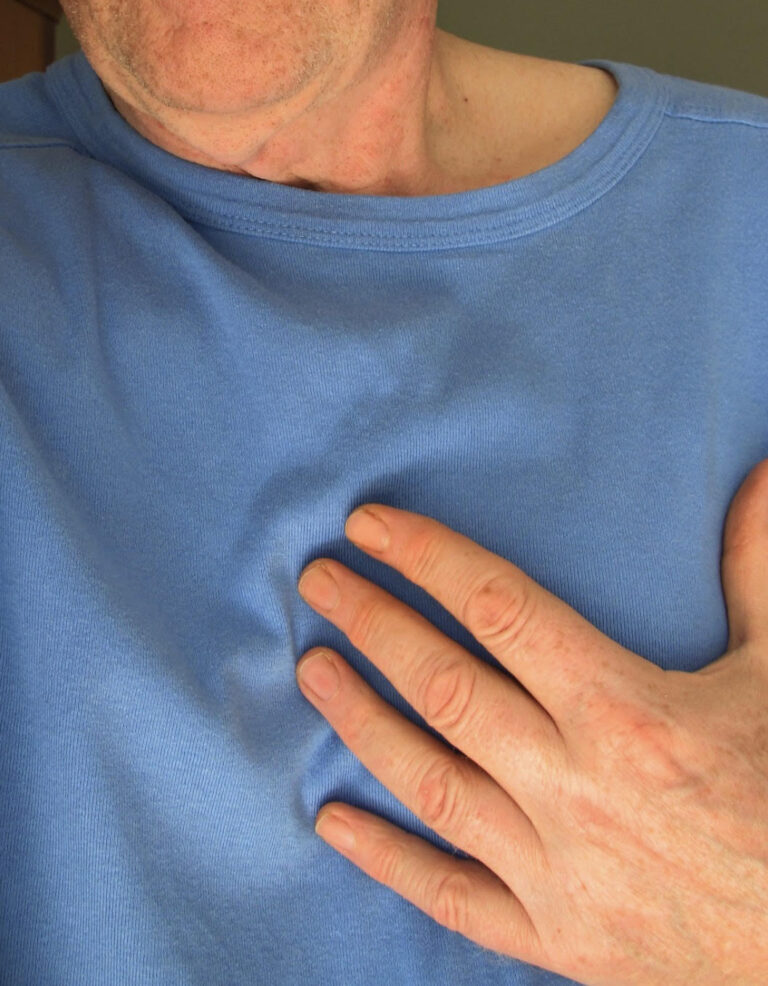 Bolesť na hrudníku, dýchavičnosť, potenie či únava môžu značiť infarkt