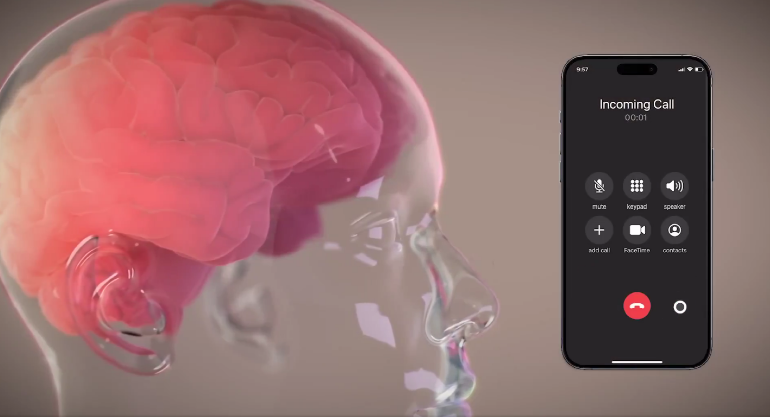 Ilustračné foto: X/Neuralink