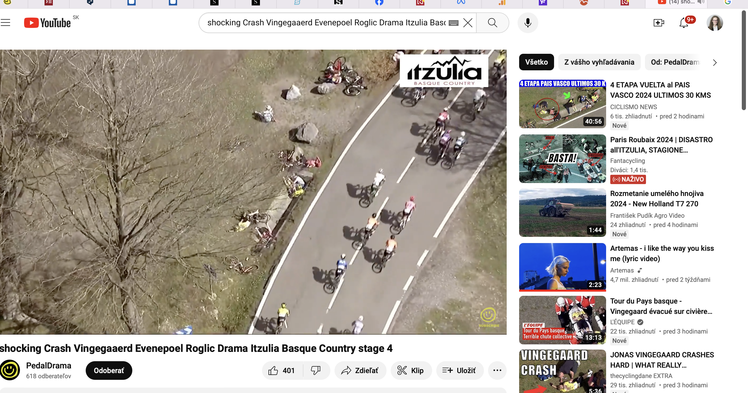 Krv, zlomené rebrá a kľúčna kosť. Preteky okolo Baskicka poznačil hororový hromadný pád