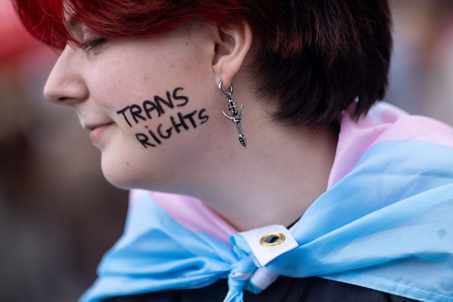 Transgender. Ilustračné foto: Profimedia.sk