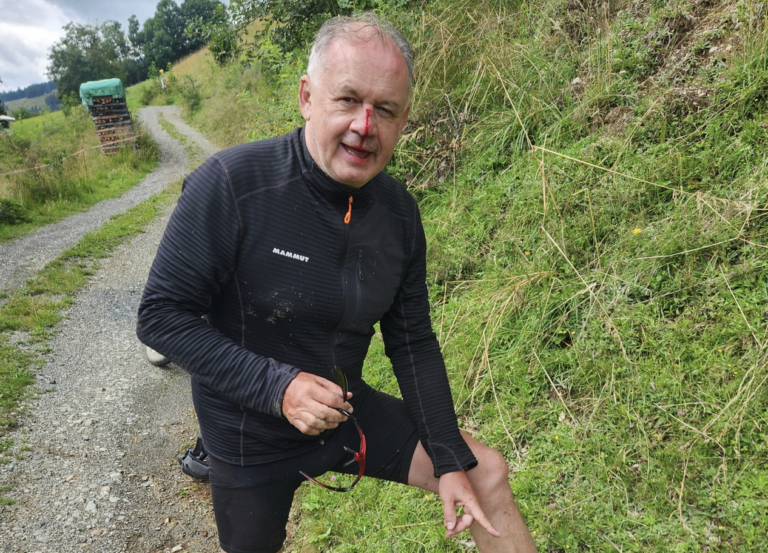 Andrej Kiska mal nehodu na bicykli. Prosím, noste prilbu, apeluje na ľudí