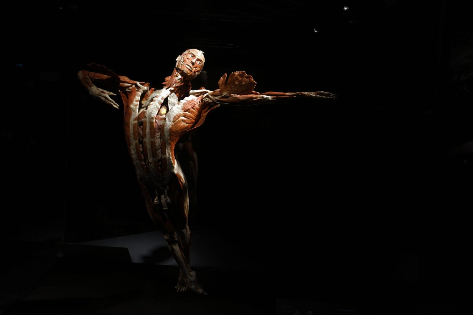 Výstava Body Worlds. Foto: Profimedia.sk