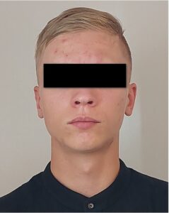 Obžalovali Samuela, ktorý nožom zabíjal na gymnáziu v Spišskej Starej Vsi