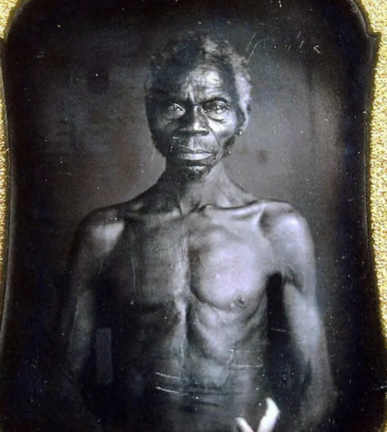 Fotografická hanba Harvardu? Potomkyňa otrokov vyhrala spor o „rasistických fotkách“