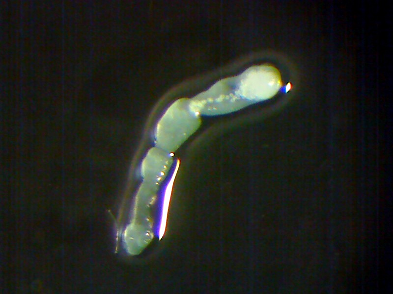 pásomnica parazitolog