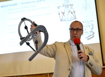 Inovatívna metóda: kruhové fixátory a softvér zachraňujú v Košiciach končatiny pred amputáciou