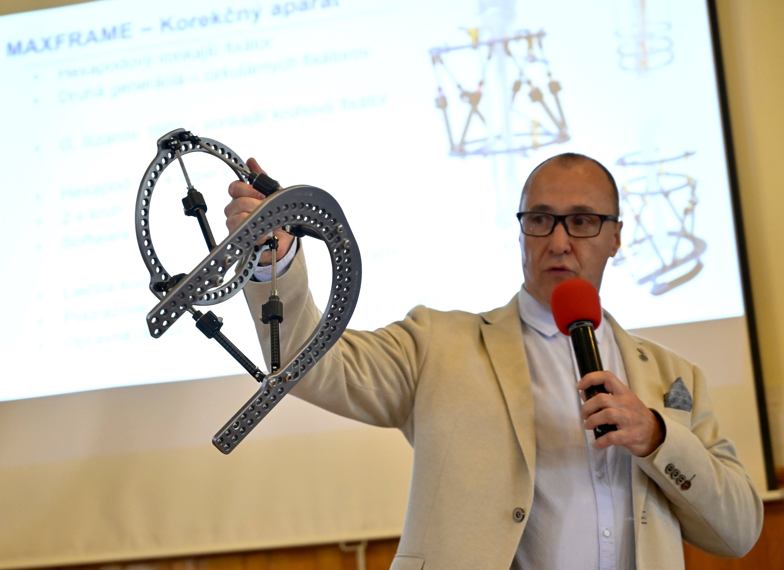 Inovatívna metóda: kruhové fixátory a softvér zachraňujú v Košiciach končatiny pred amputáciou