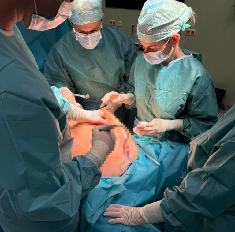 Slovenskí lekári odstránili pacientke nádor, ktorý mal 18,6 kilogramu