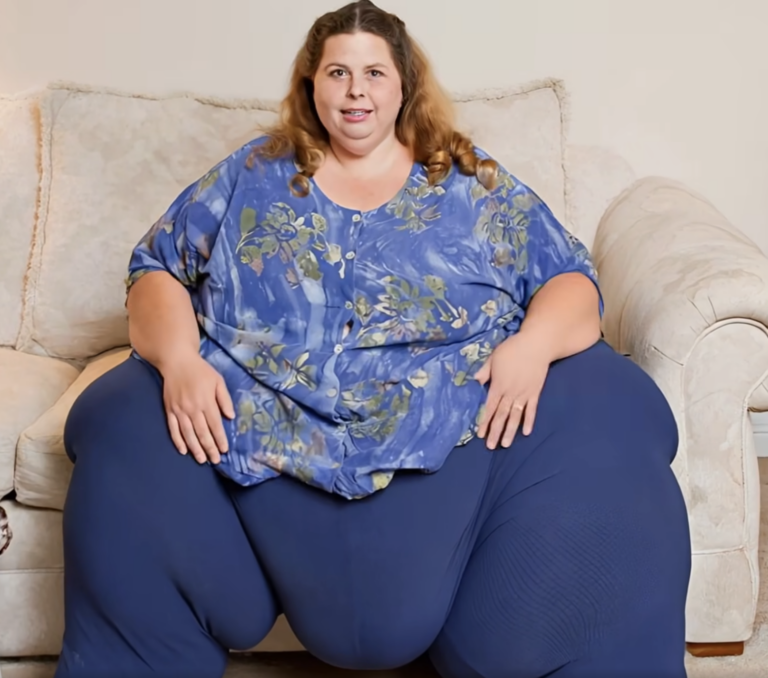 WHO prvý raz odporučí lieky na chudnutie ako liečbu obezity u dospelých