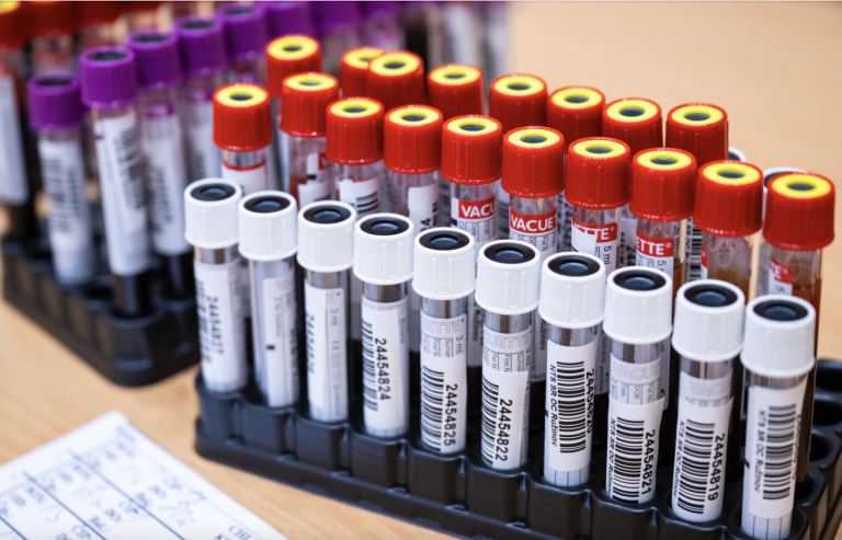 Poslankyňa odhalila škandál. Slovenskú krv  využívali v Holandsku nelegálne