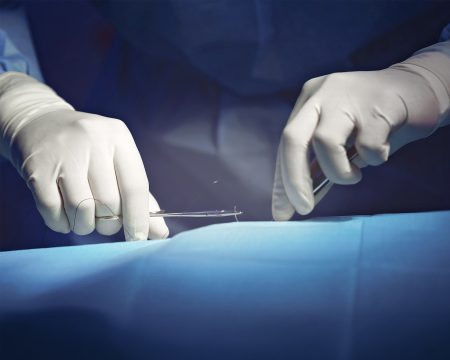 Nemocniciam klesajú výkony. Rezort skúma, či preto, že lekári pracujú na viacerých miestach