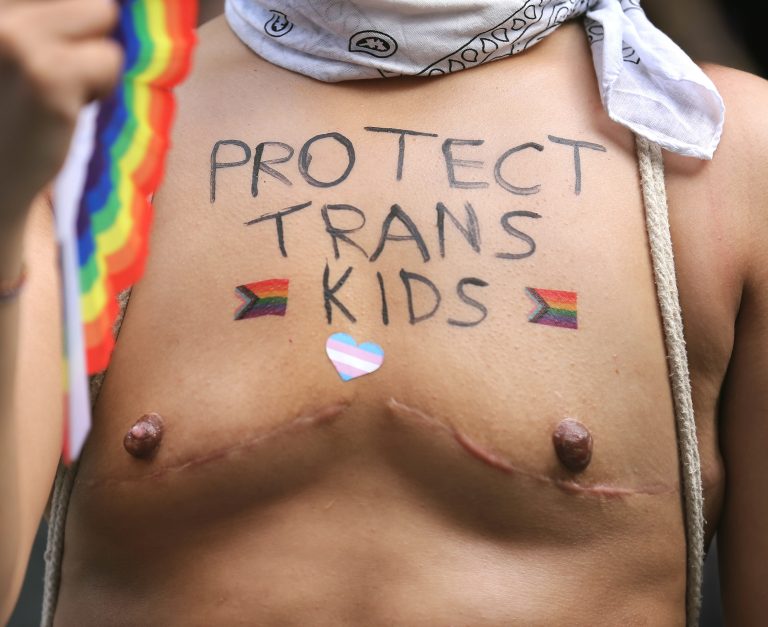 Protestujúci má na zjazvenej hrudi nápis „Protect Trans Kids“ (Chráňte transsexuálne deti). Foto: Martin Pope/Getty Images