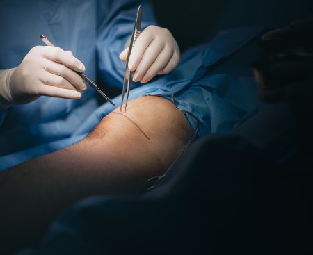 Historický míľnik v Prešove. Nová metóda dáva pacientom šancu vyhnúť sa amputácii