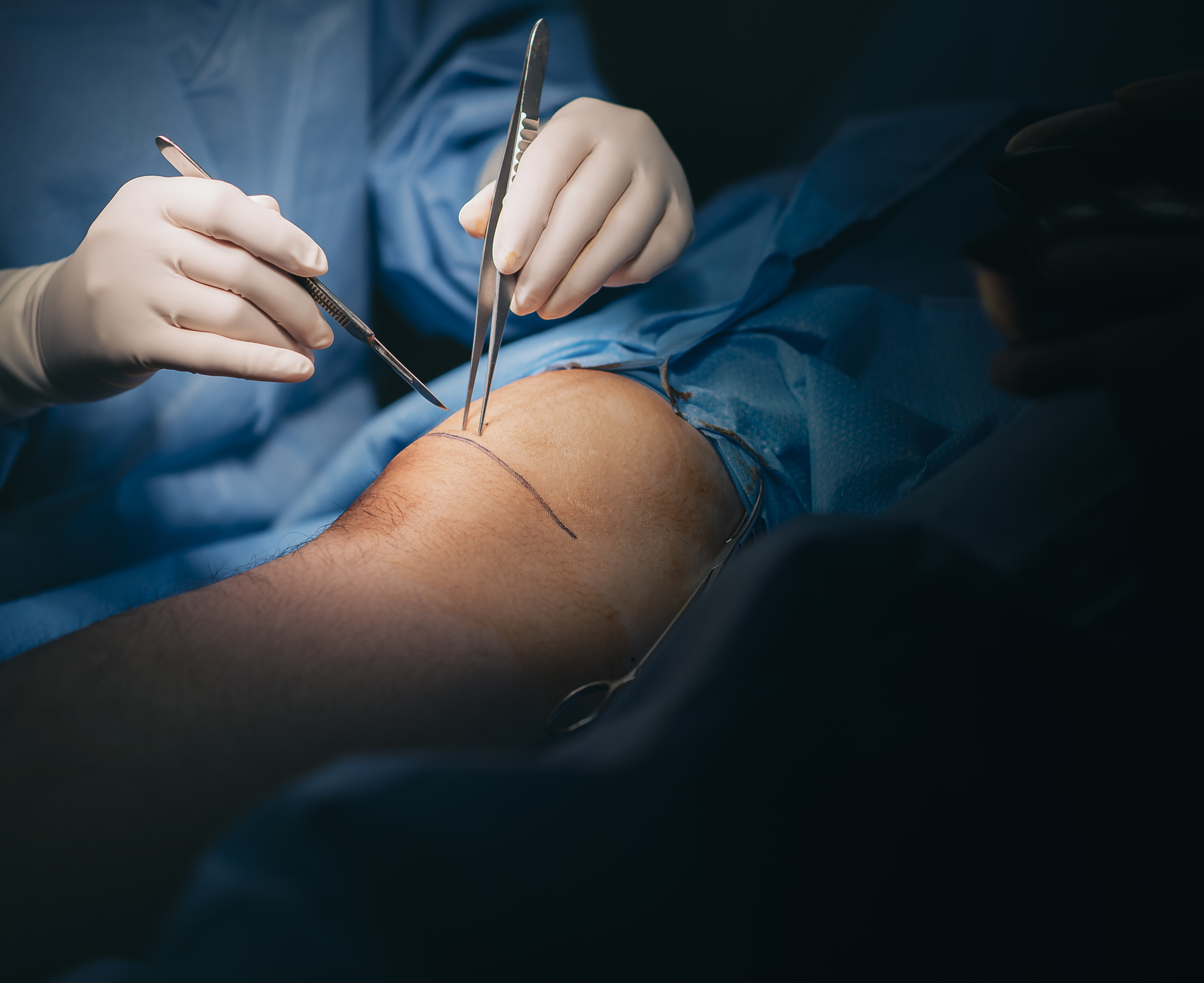 Historický míľnik v Prešove. Nová metóda dáva pacientom šancu vyhnúť sa amputácii