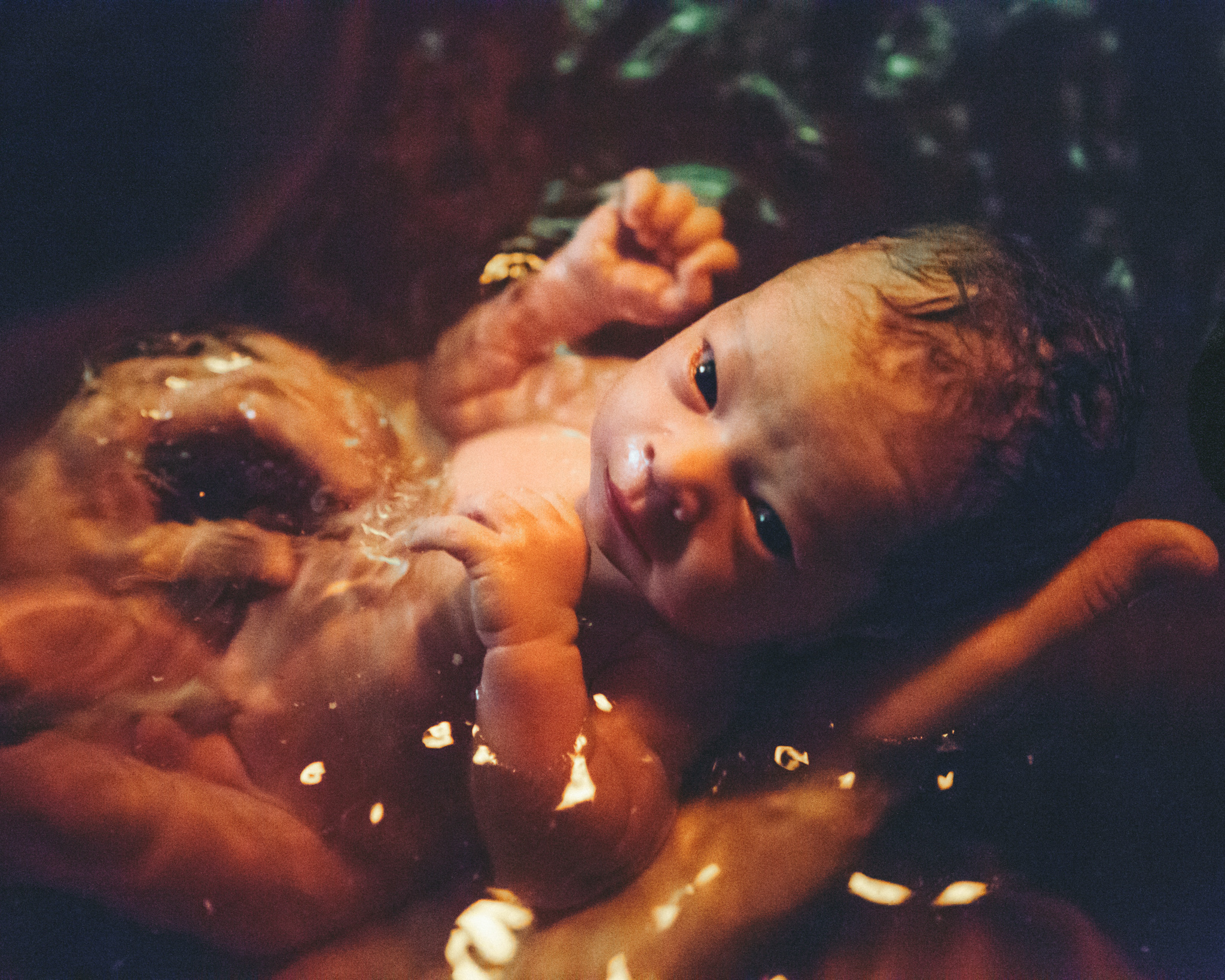 Už sa nerodí len „na koze“ s nohami hore. Pôrodnice sa otvárajú inovatívnym metódam