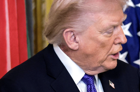 White House confirms preventive treatment for Trump’s neck rash