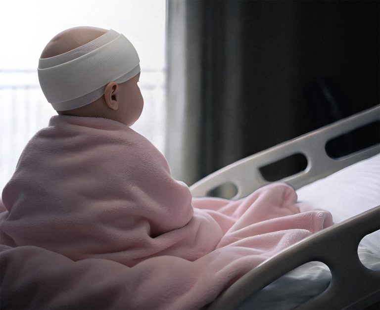 Rare Brain Surgery Leaves Young Epilepsy Patient Seizure-Free