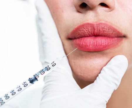 Slovenské ženy menia prístup k estetickým zákrokom. Chcú prirodzenosť, nie extrémy