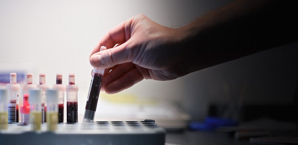 Sexually Transmitted Infections Surge in Europe
