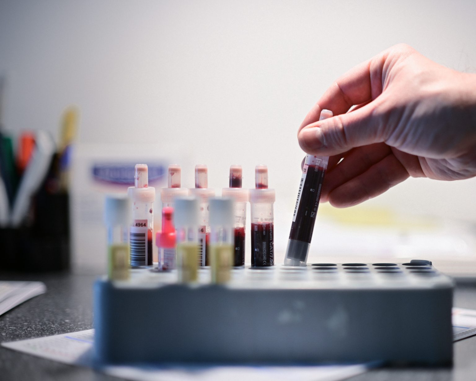 Testing and migration affect the spread of STIs in Europe.