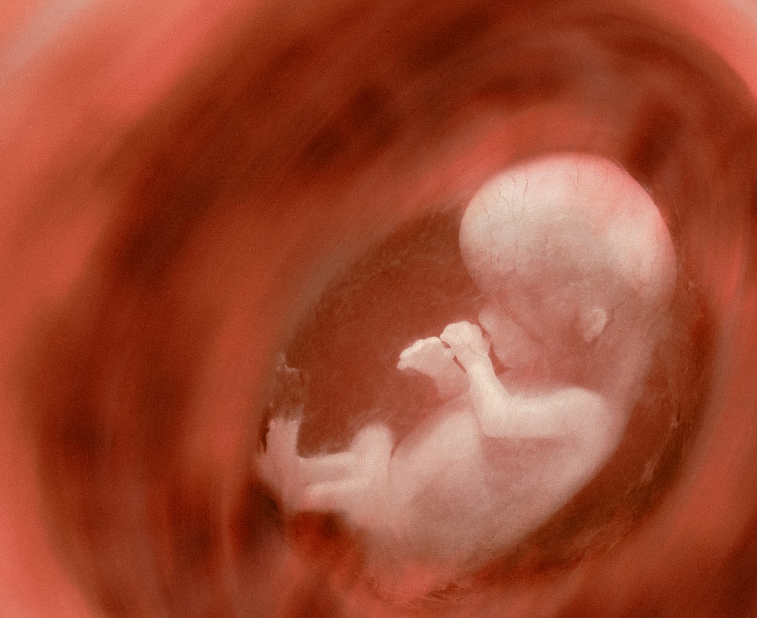 Unborn child at 10 weeks.