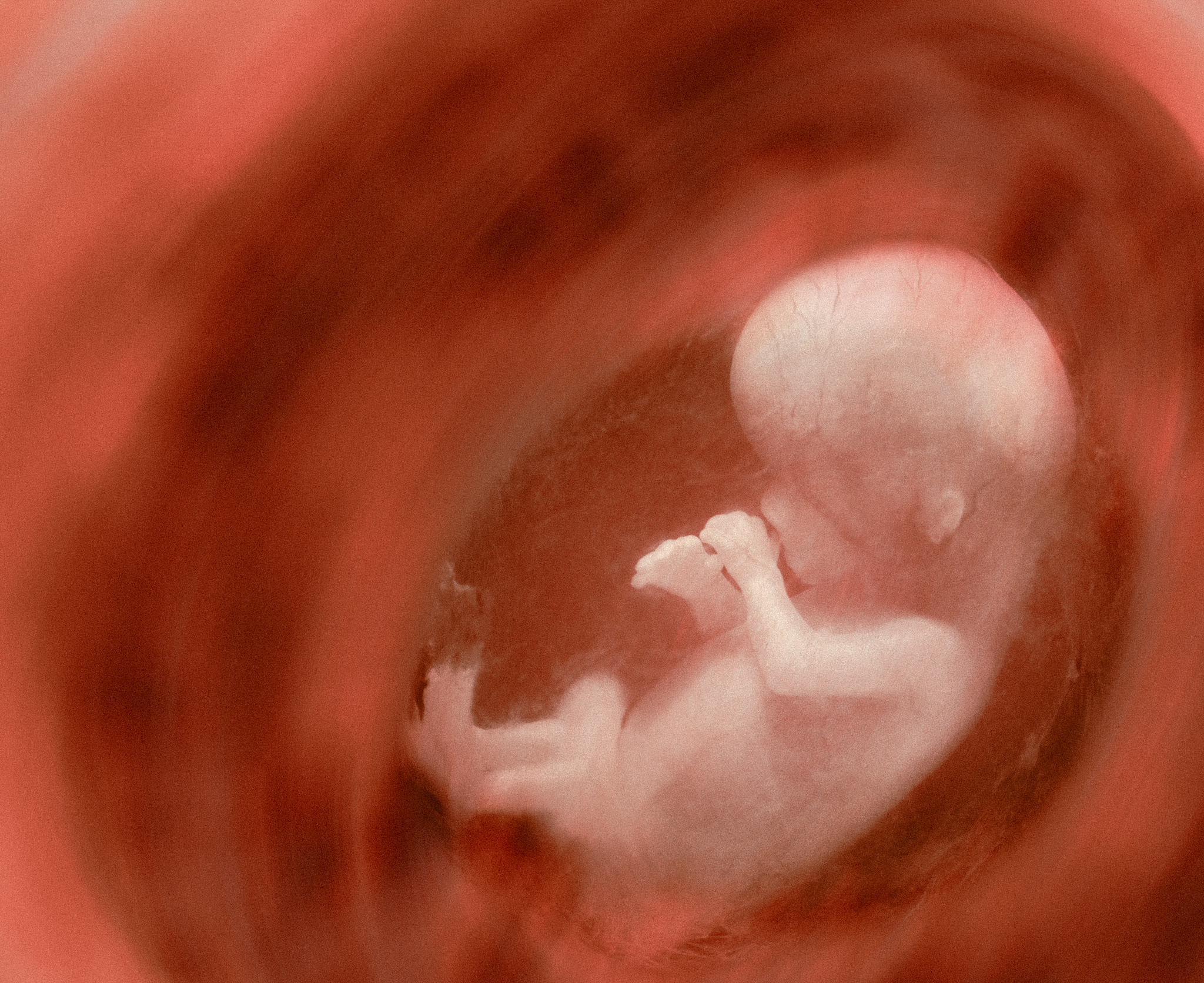 Catholic Women’s Group Turns Against Protection of Unborn Children