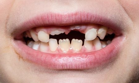 Could Growing New Teeth Change Modern Dentistry?
