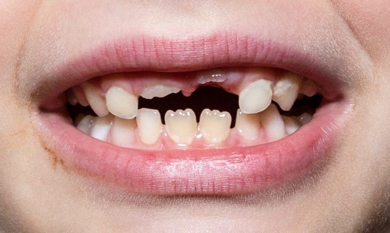 Could Growing New Teeth Change Modern Dentistry?