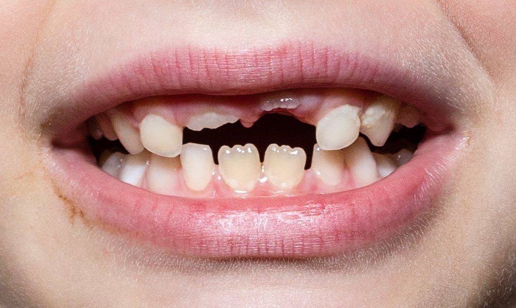 What if lost teeth could be regrown instead of replaced with costly implants? Photo: Benjamin Beytekin/picture alliance via Getty Images