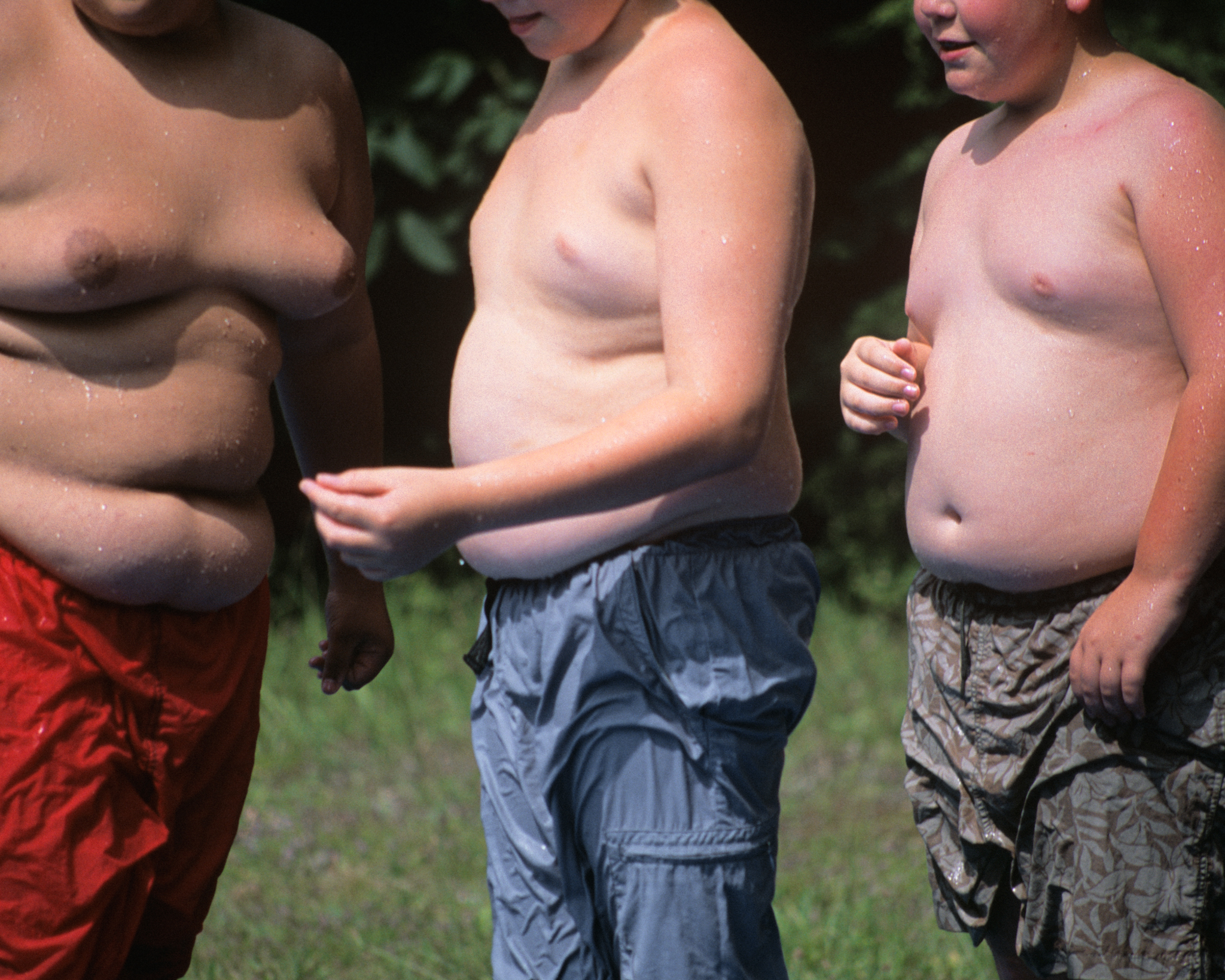 Každé piate dieťa má nadváhu alebo obezitu. Rodičia problém často nevidia
