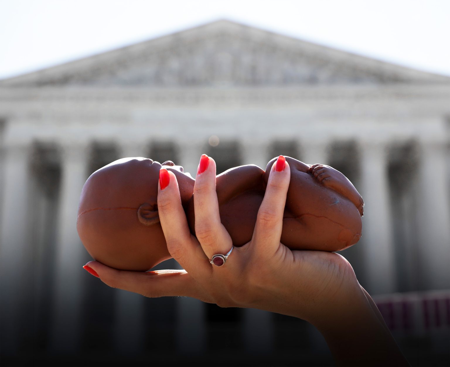 Considerations for legal protection of unborn children.
