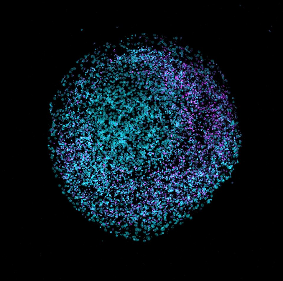 2D cryosection of a human brain organoid stained with DAPI (teal) and VIPR2 (magenta). Source: Nreis1/Wikimedia Commons