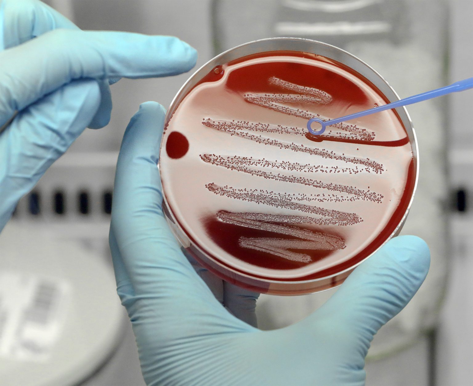 Gene editing offers lifesaving potential.